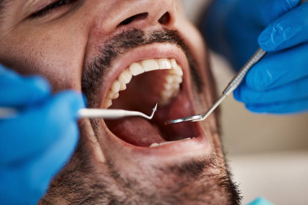 Best Dentist for Tooth Abscess  in Buckley, WA